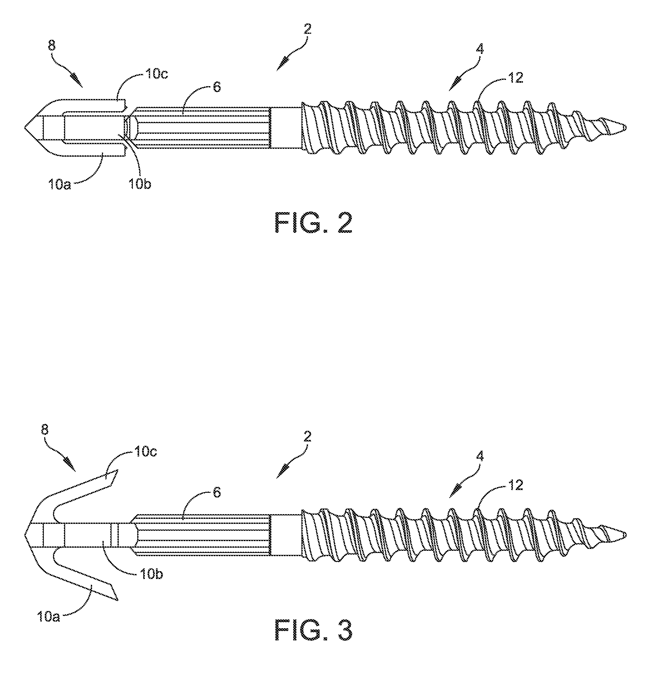 Hammertoe implant and instrument