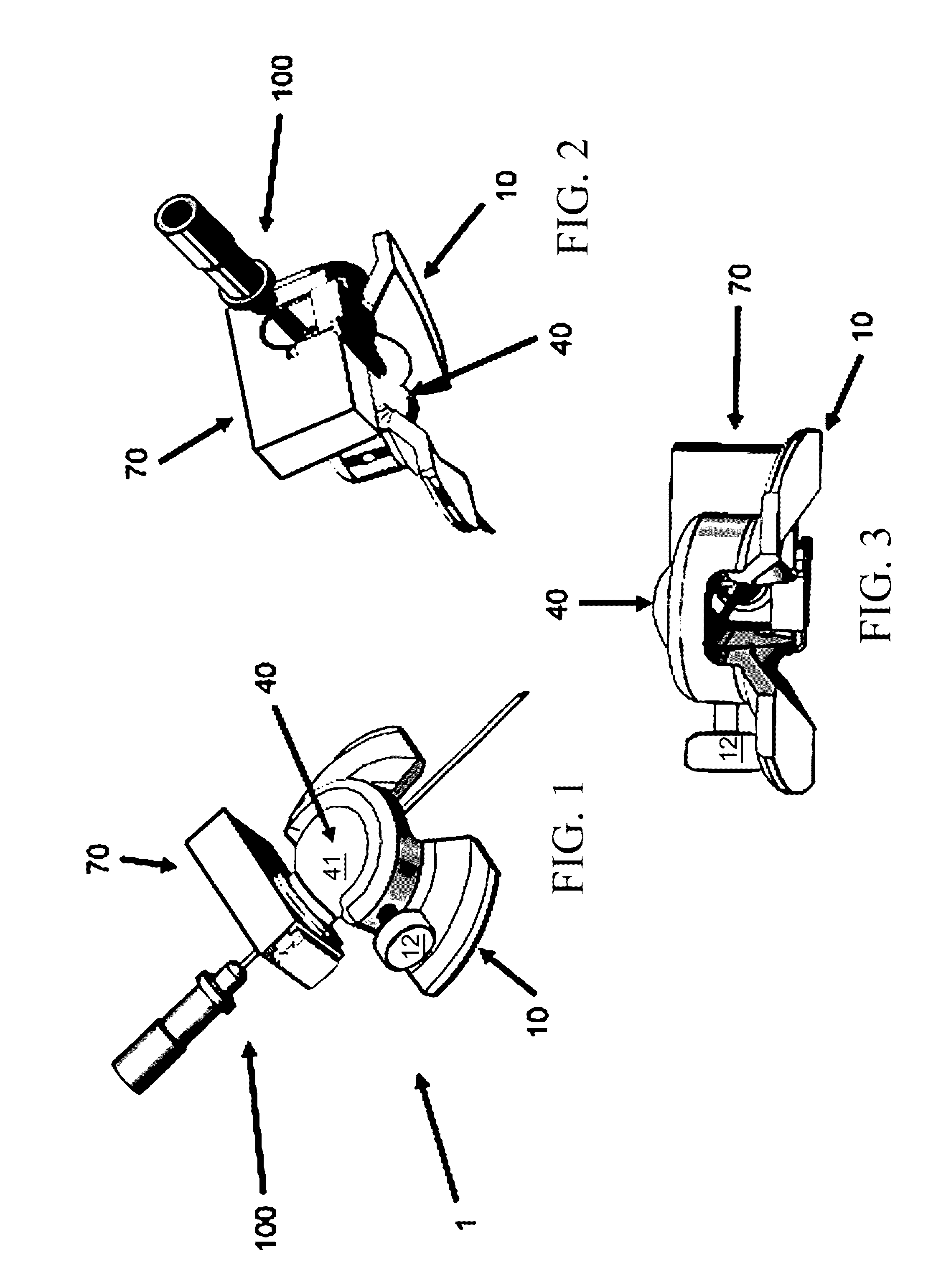 Procedural assist device