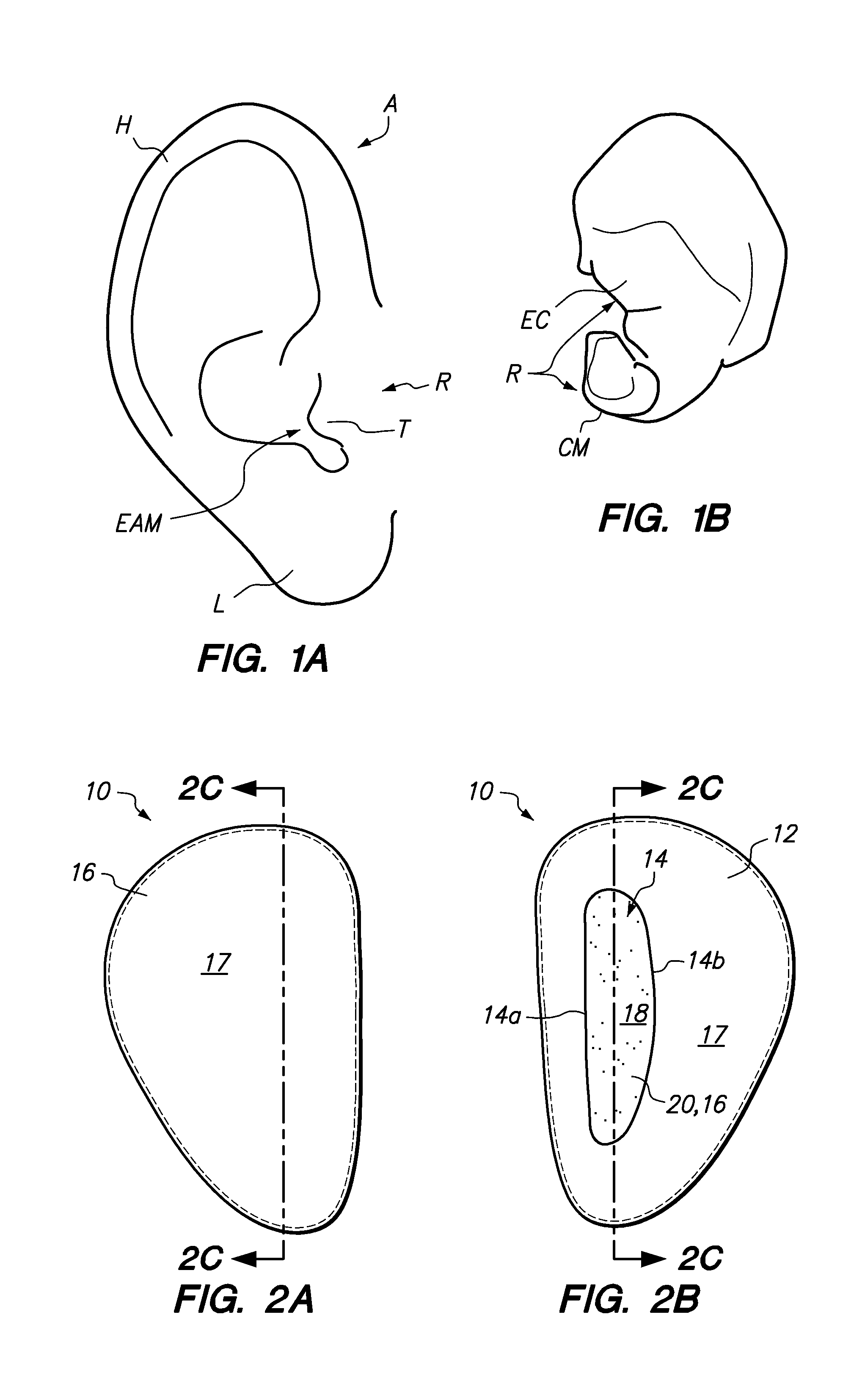 Methods and apparatus for ear protection