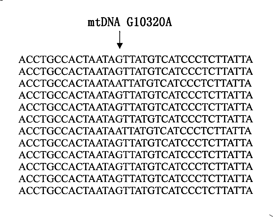 SNP G10320A molecular marker of mitochondrion ND3 gene of senescence-associated degenerative disease, detecting method and kit thereof
