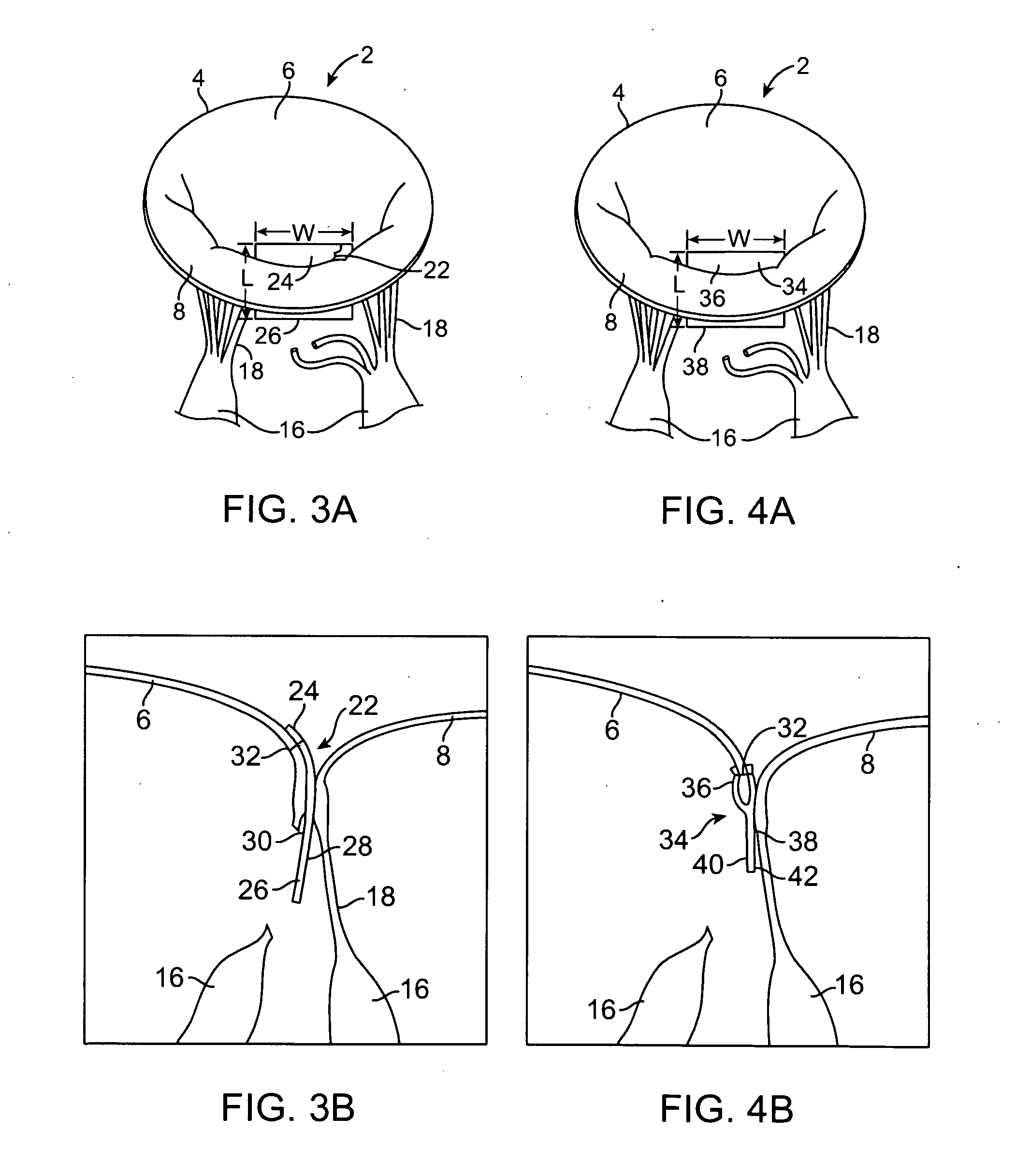 Devices and methods for repairing cardiac valves