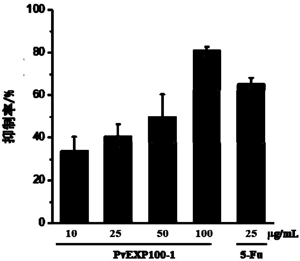 Preparation method and application of antitumor protein