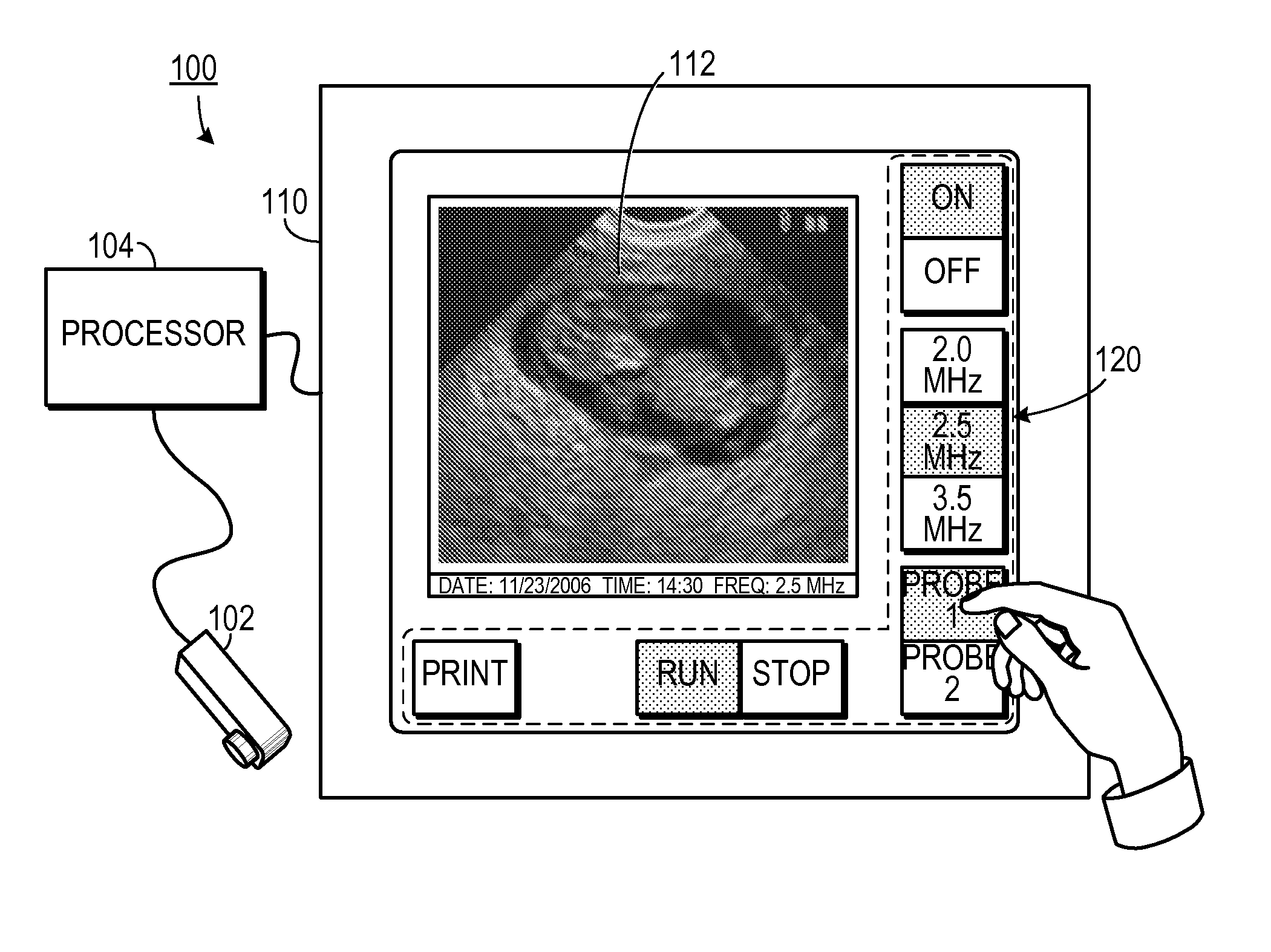 Portable ultrasound with touch screen interface
