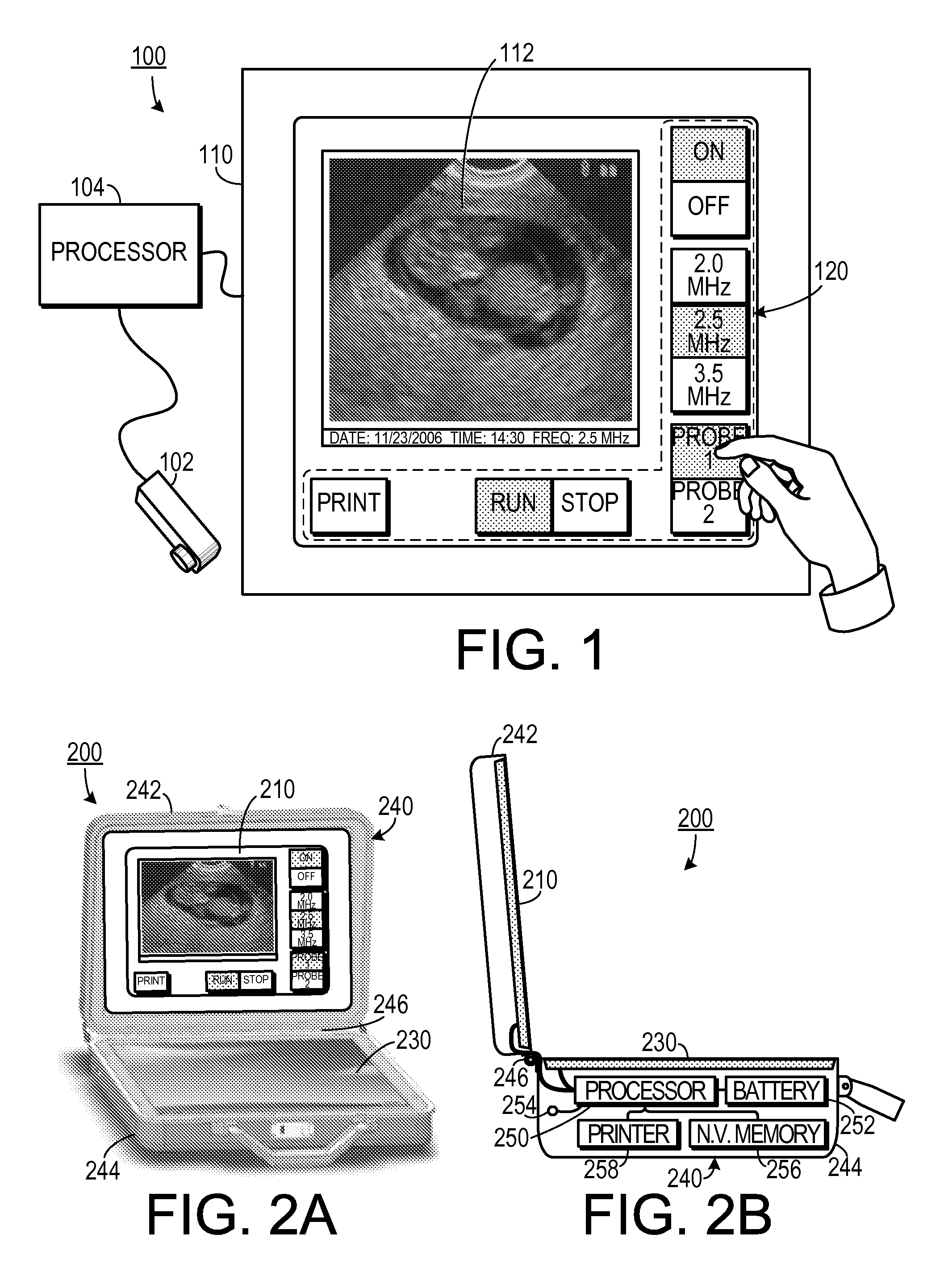 Portable ultrasound with touch screen interface