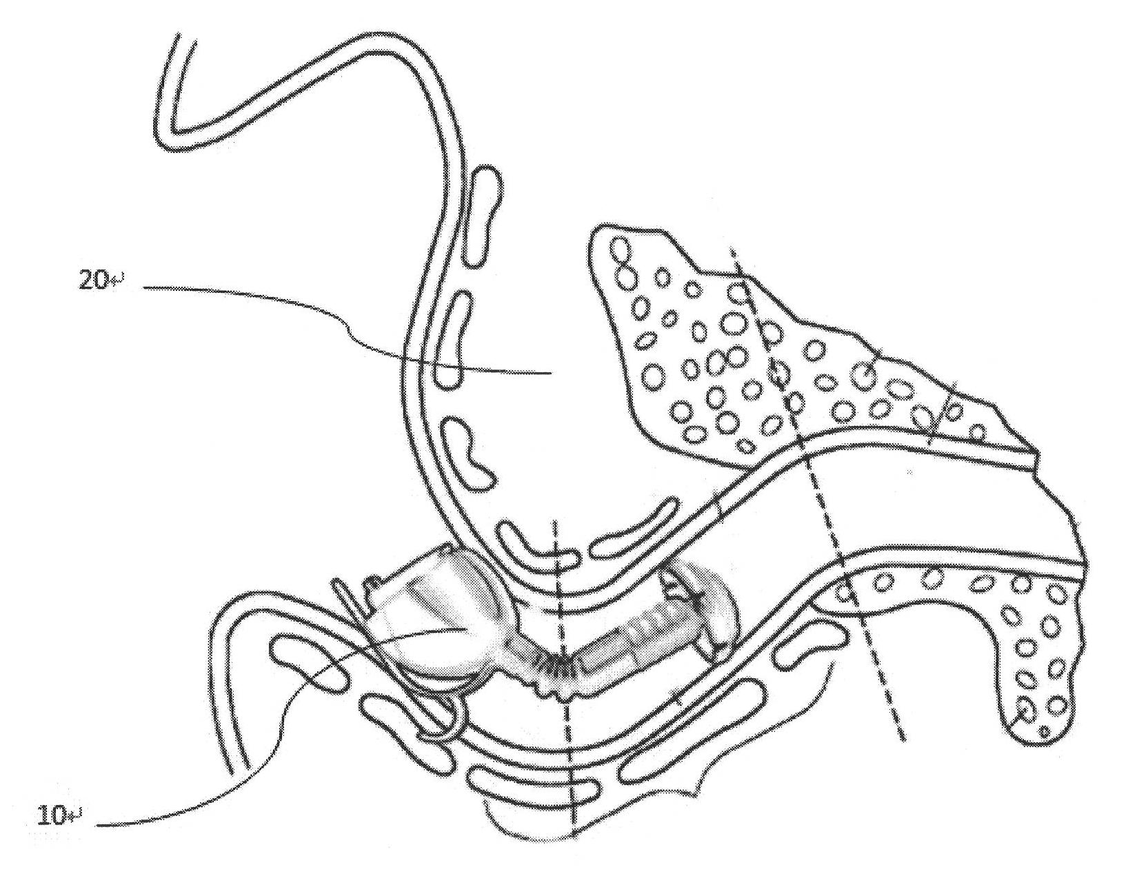 Novel in-ear hearing aid