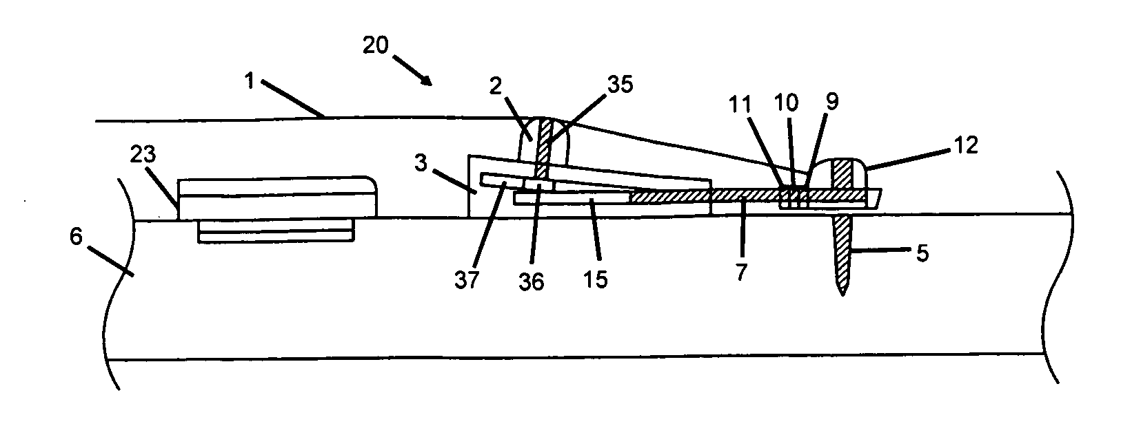 Bridge system for improved acoustic coupling in stringed instruments