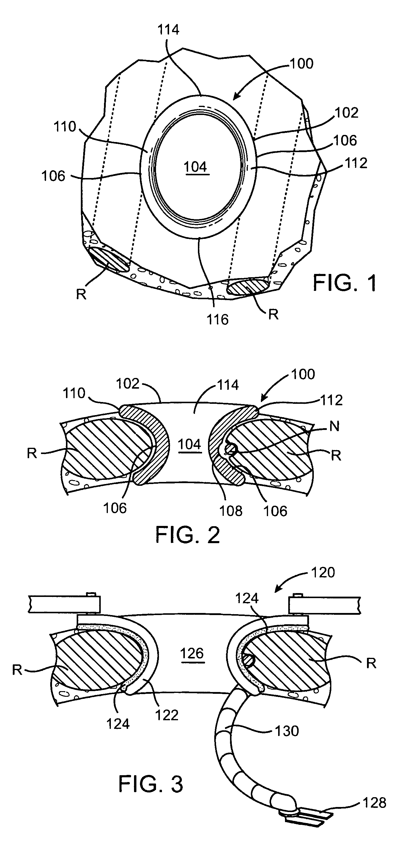 Retractor with inflatable blades