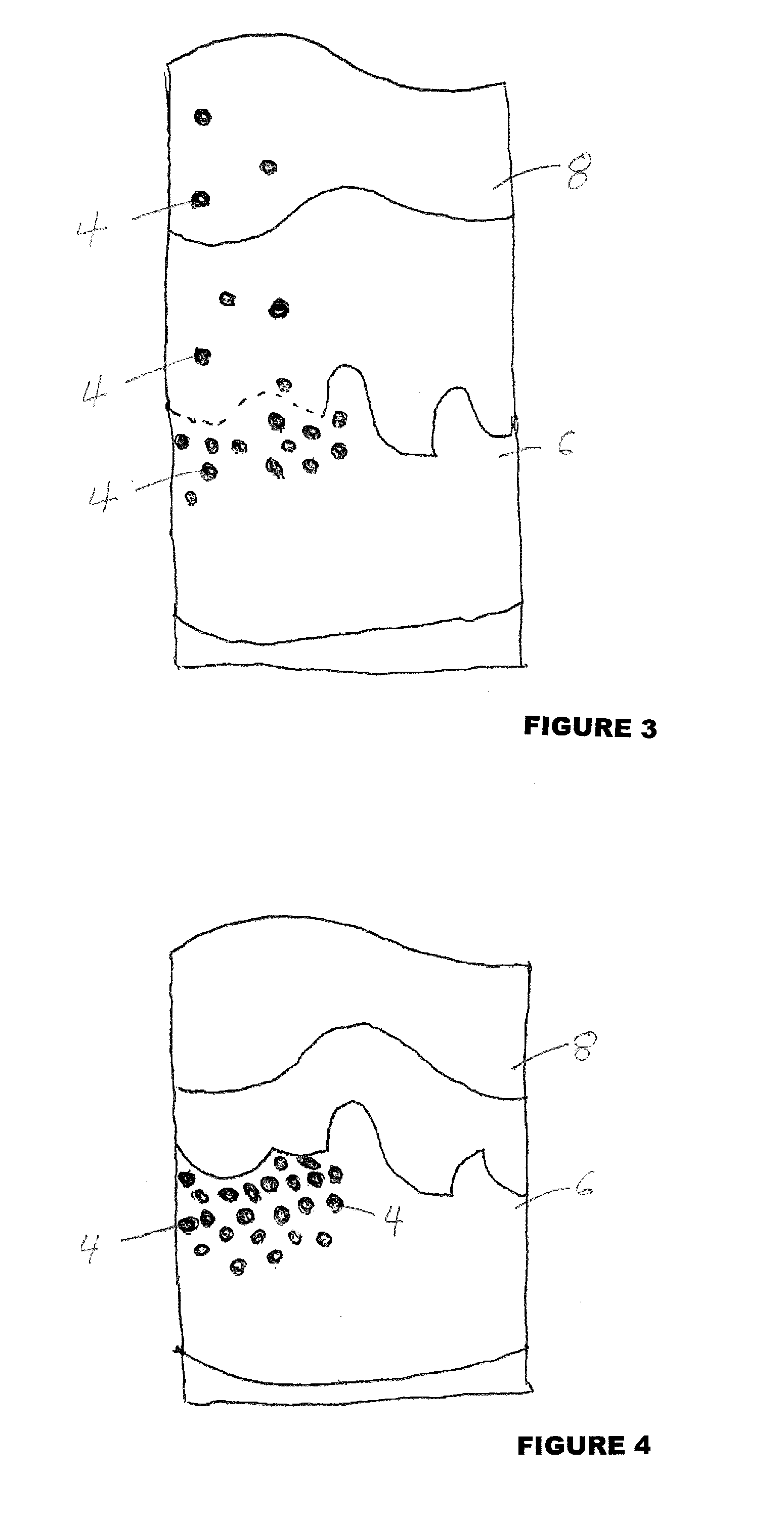 Reversible tattoo colorant and method