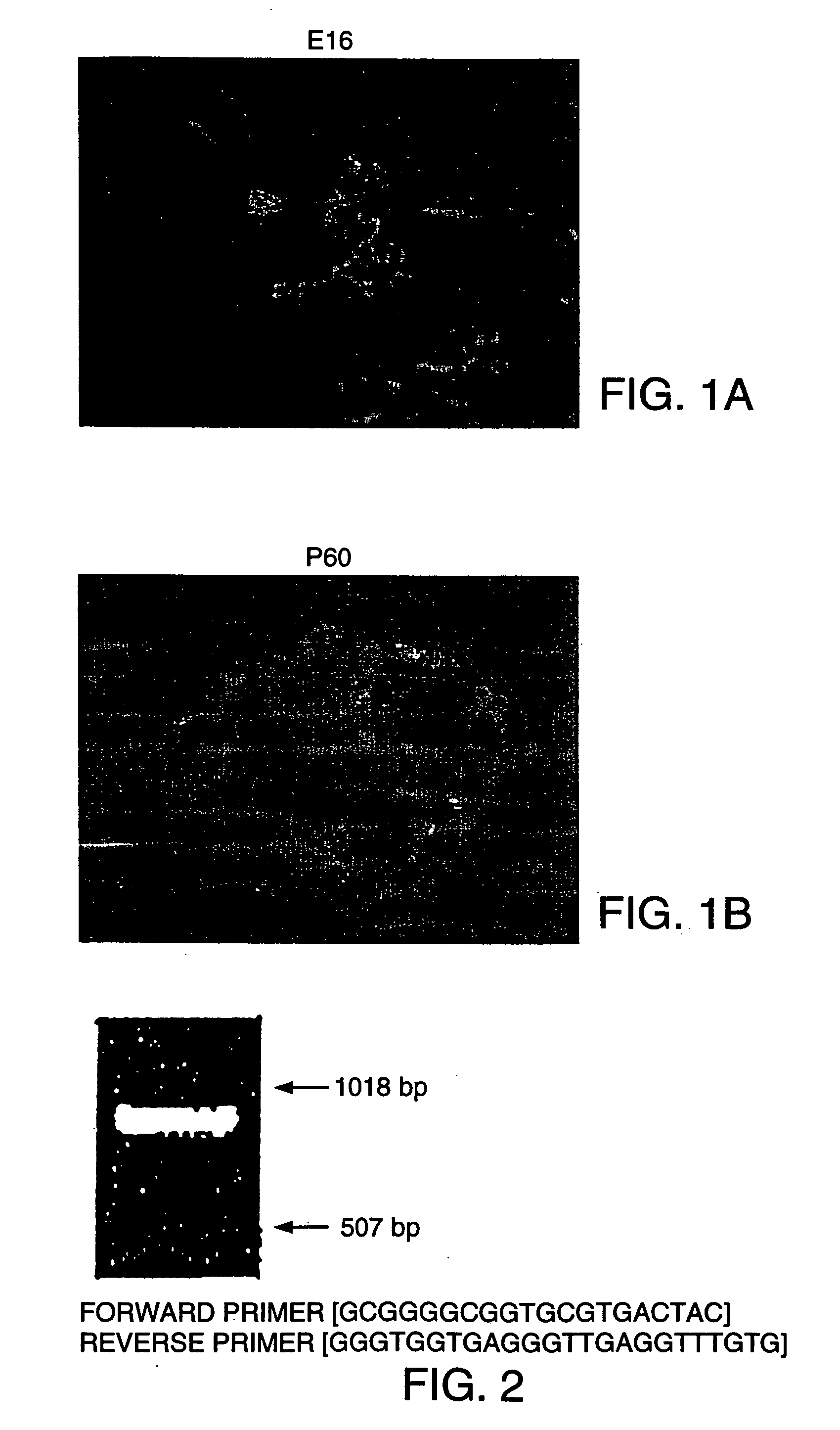 Method of transplanting in a mammal and treating diabetes mellitus by administering a pseudo-islet like aggregate differentiated from a nestin-positive pancreatic stem cell