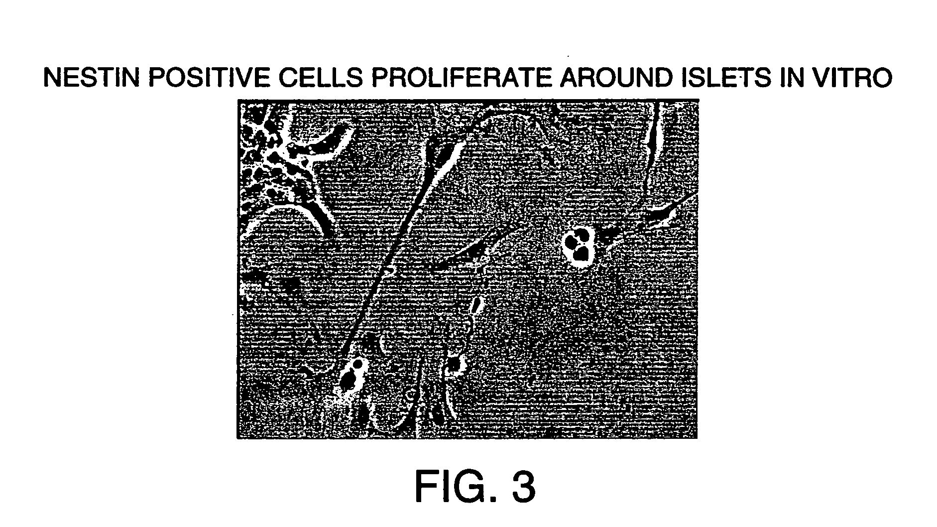 Method of transplanting in a mammal and treating diabetes mellitus by administering a pseudo-islet like aggregate differentiated from a nestin-positive pancreatic stem cell