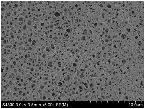 Ethylene-chlorotrifluor ethylene copolymer microporous separation membrane, preparation method and application thereof