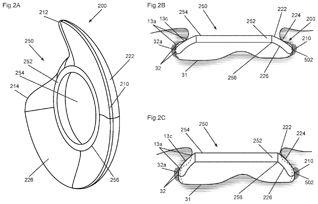 Skirt attachment