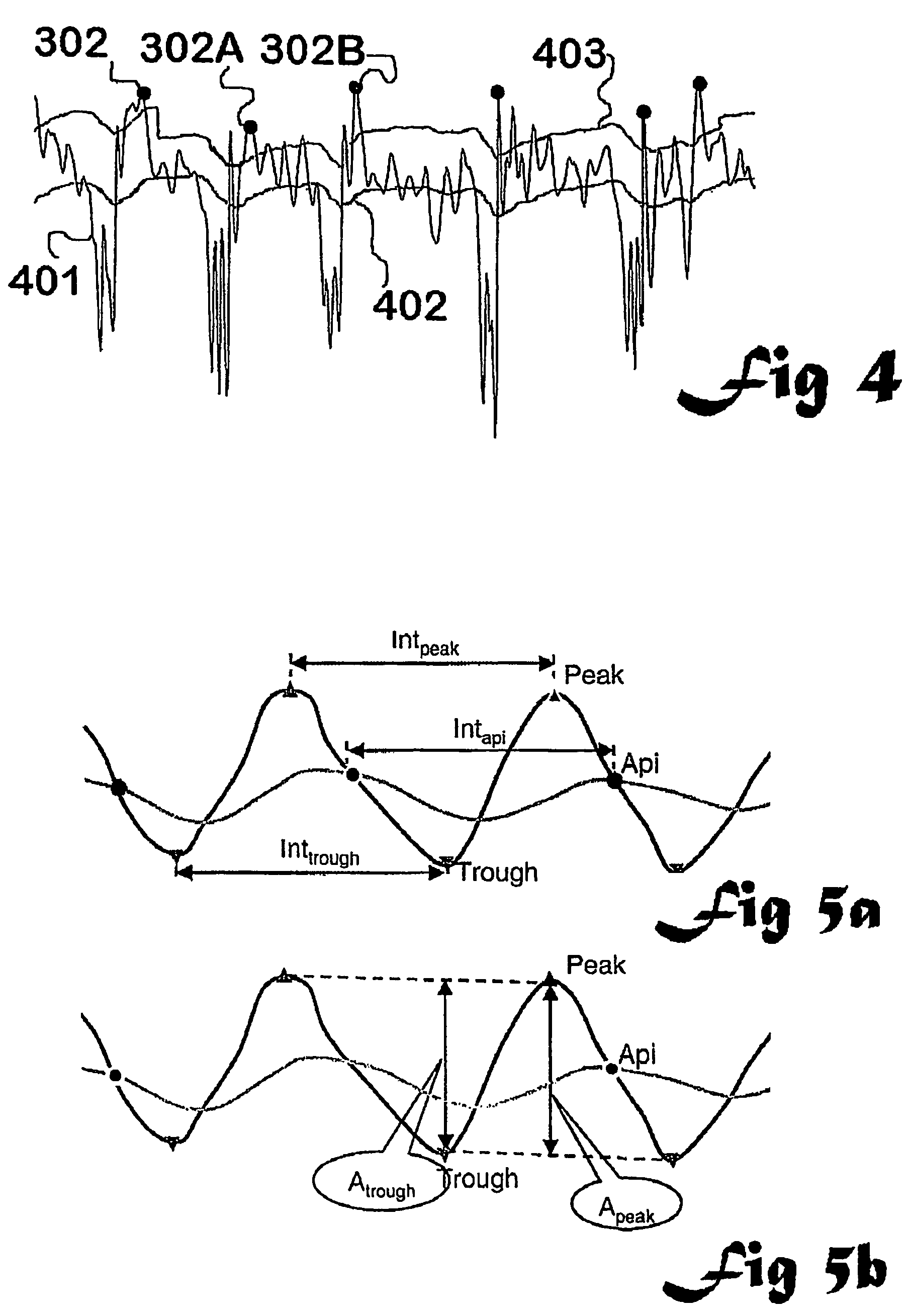 EEG seizure analysis