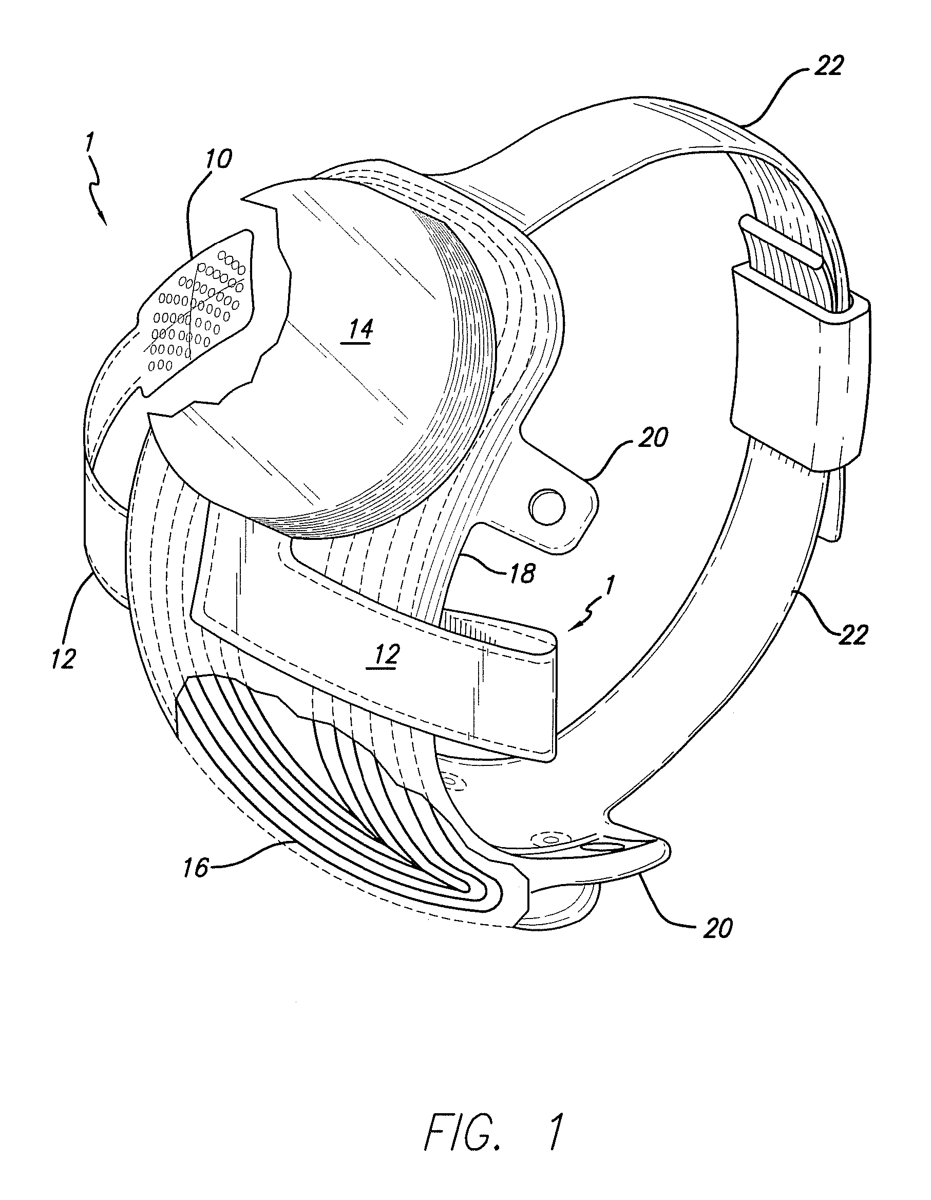 Flexible circuit electrode array with at least one tack opening