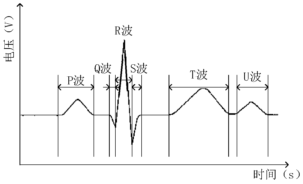 Atrioventricular block detection method, apparatus and electronic equipment base on electrocardiograph signals