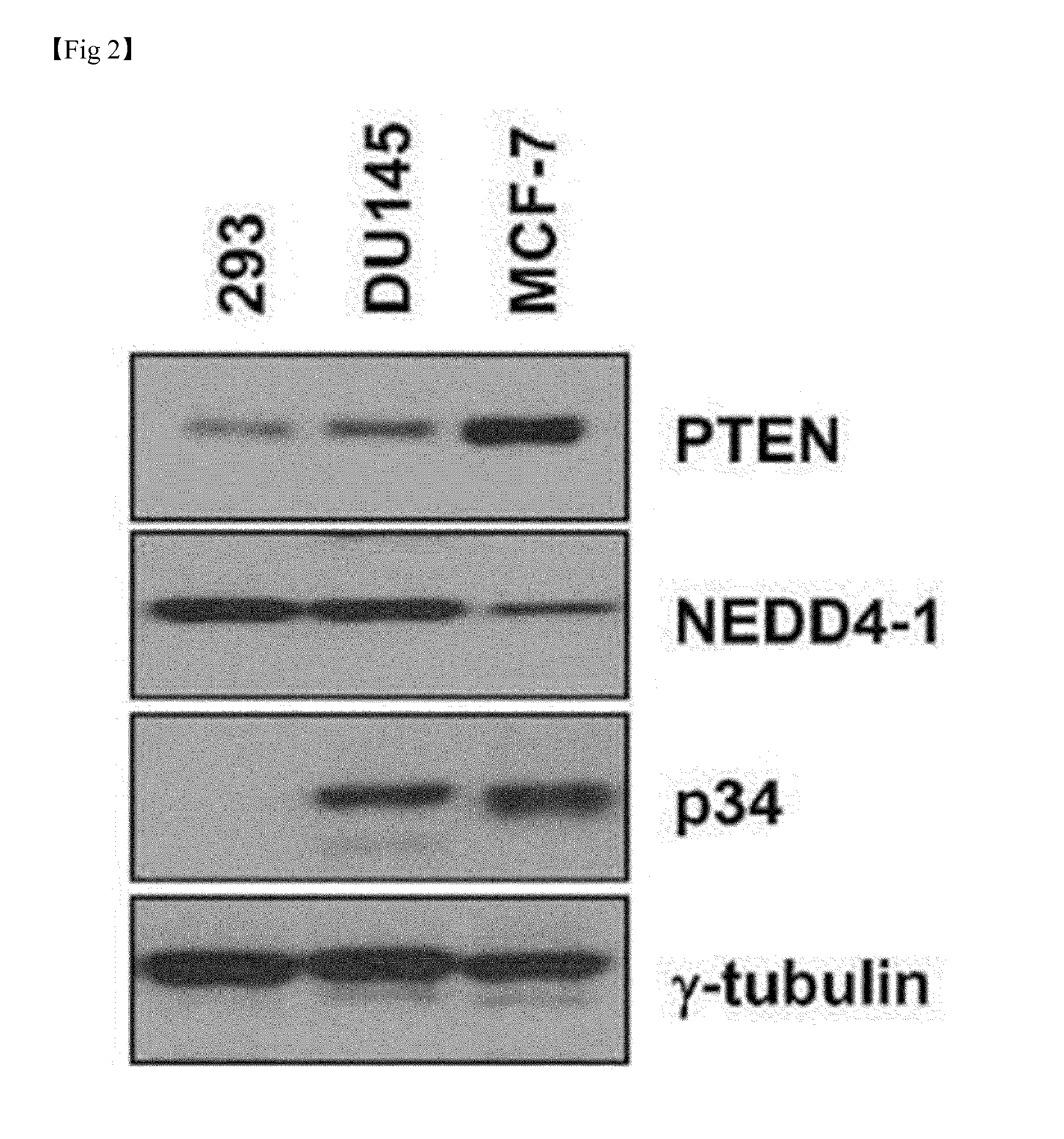 Composition for Treatment or Metastasis Suppression of Cancers Which Includes P34 Expression Inhibitor or Activity Inhibitor as Active Ingredient