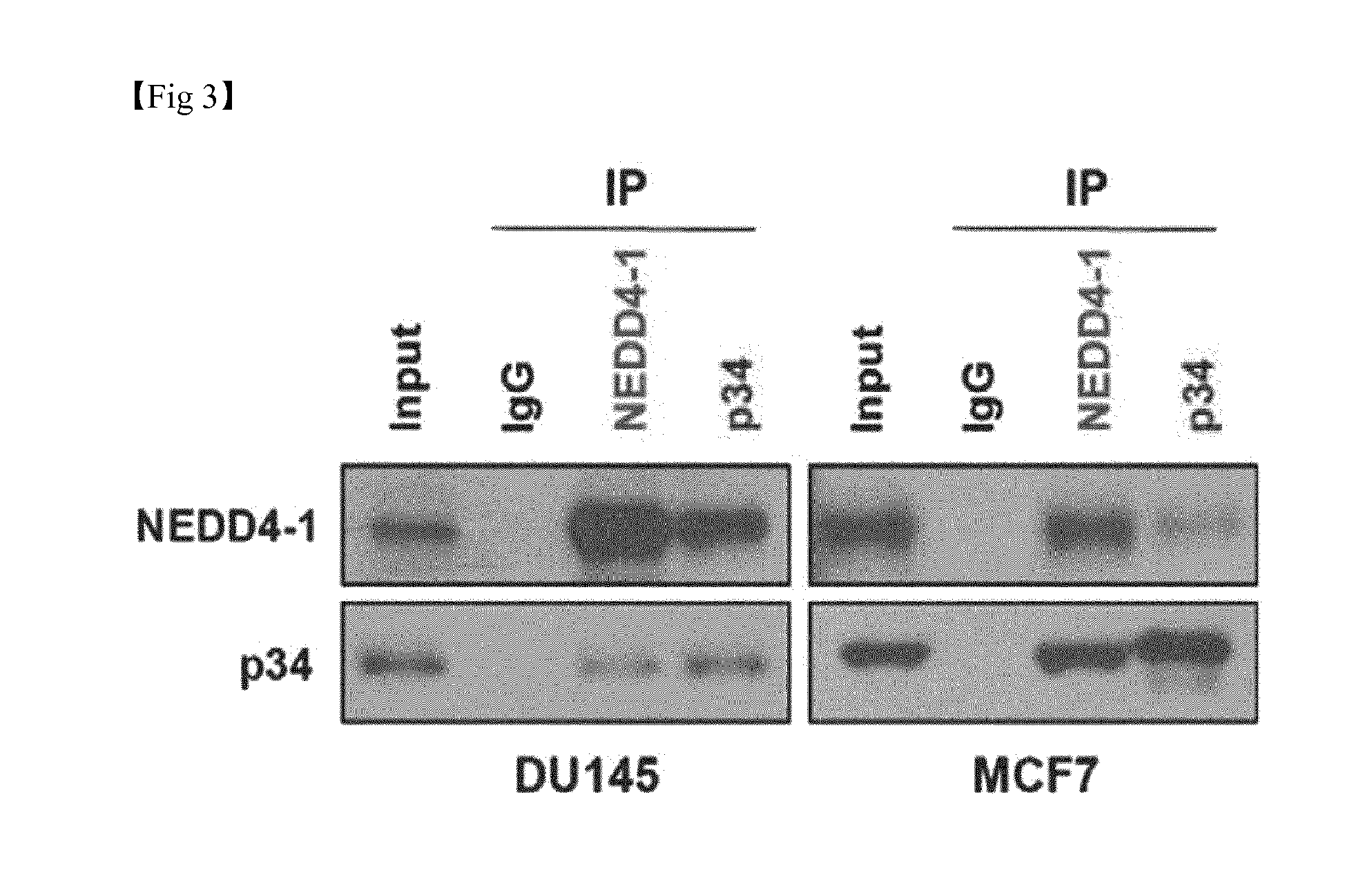 Composition for Treatment or Metastasis Suppression of Cancers Which Includes P34 Expression Inhibitor or Activity Inhibitor as Active Ingredient
