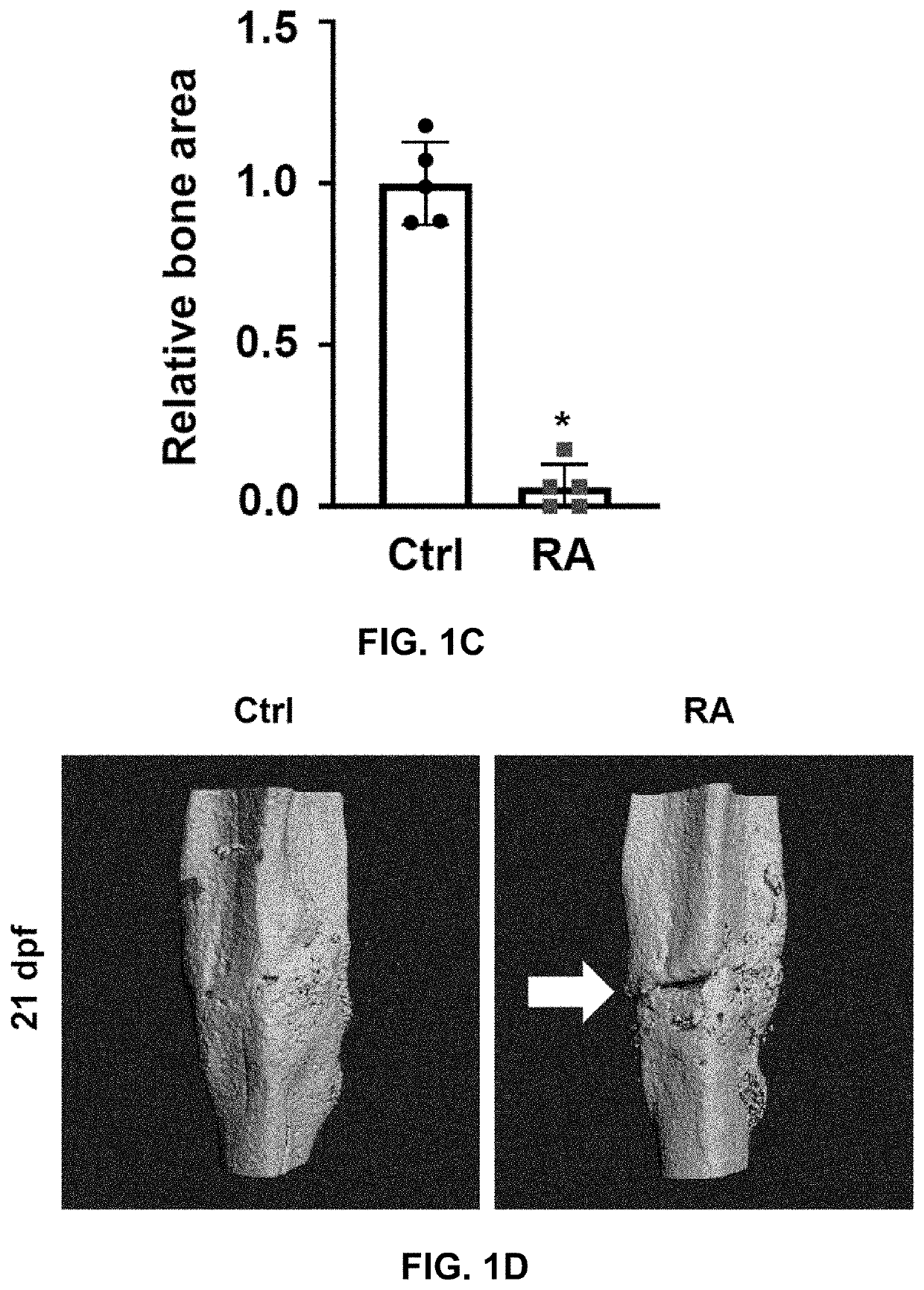 Compositions and methods for targeting angiogenesis for fracture nonunion treatment under inflammatory diseases
