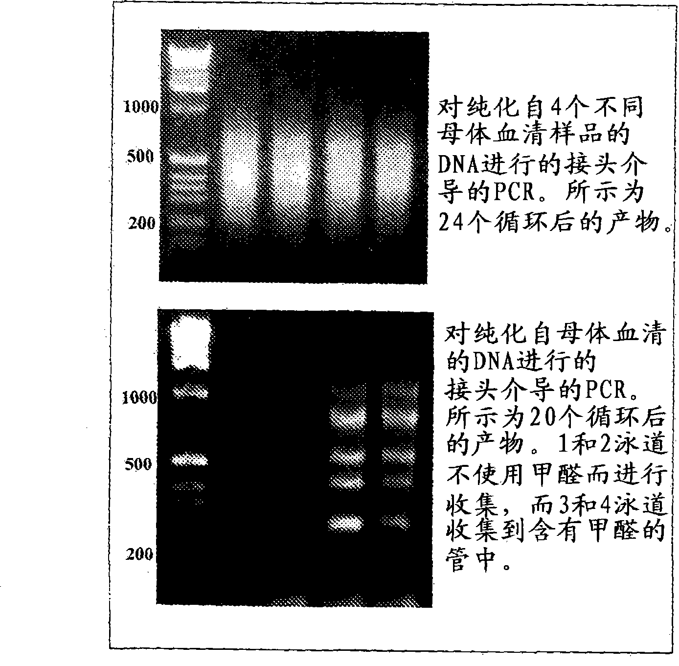 Specific amplification of fetal DNA sequences from a mixed, fetal-maternal source