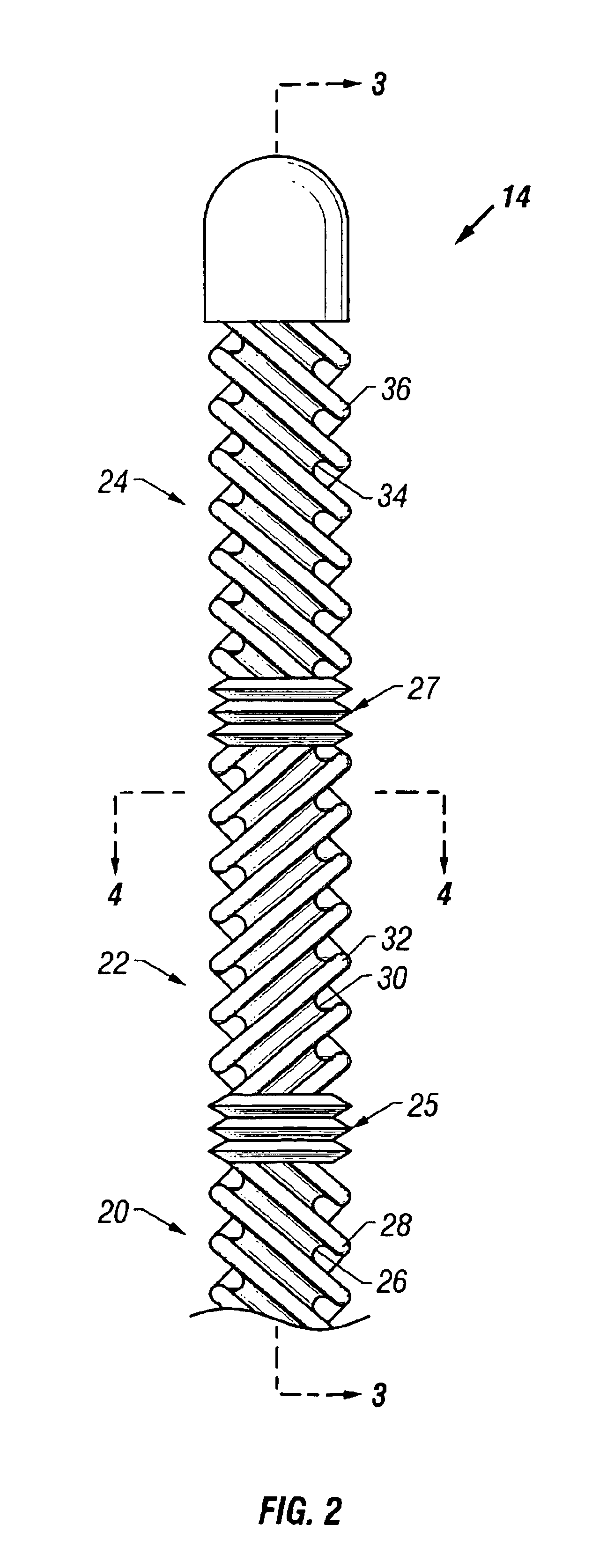 Selective organ cooling catheter with guidewire apparatus and temperature-monitoring device