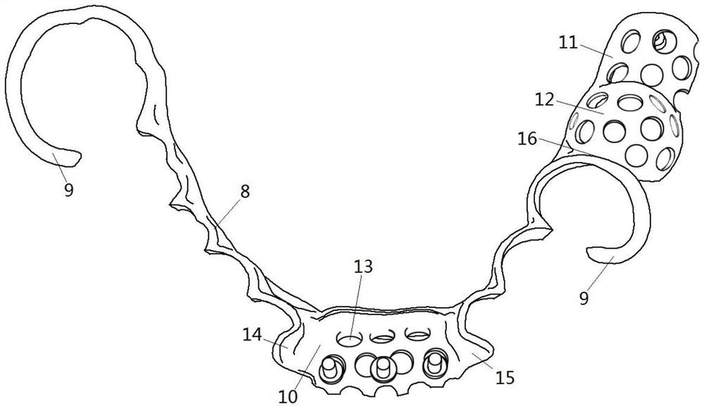 Preparation guide plate and removable partial denture support modelconstruction method and manufacturing method