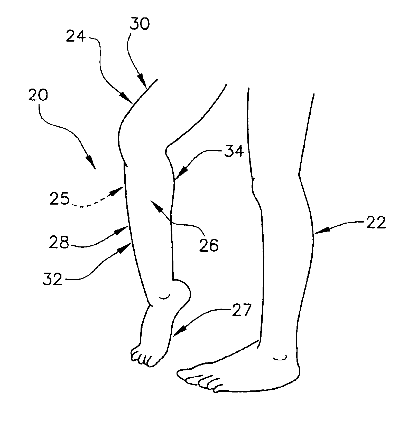 Method and apparatus for determining a dorsiflexion angle