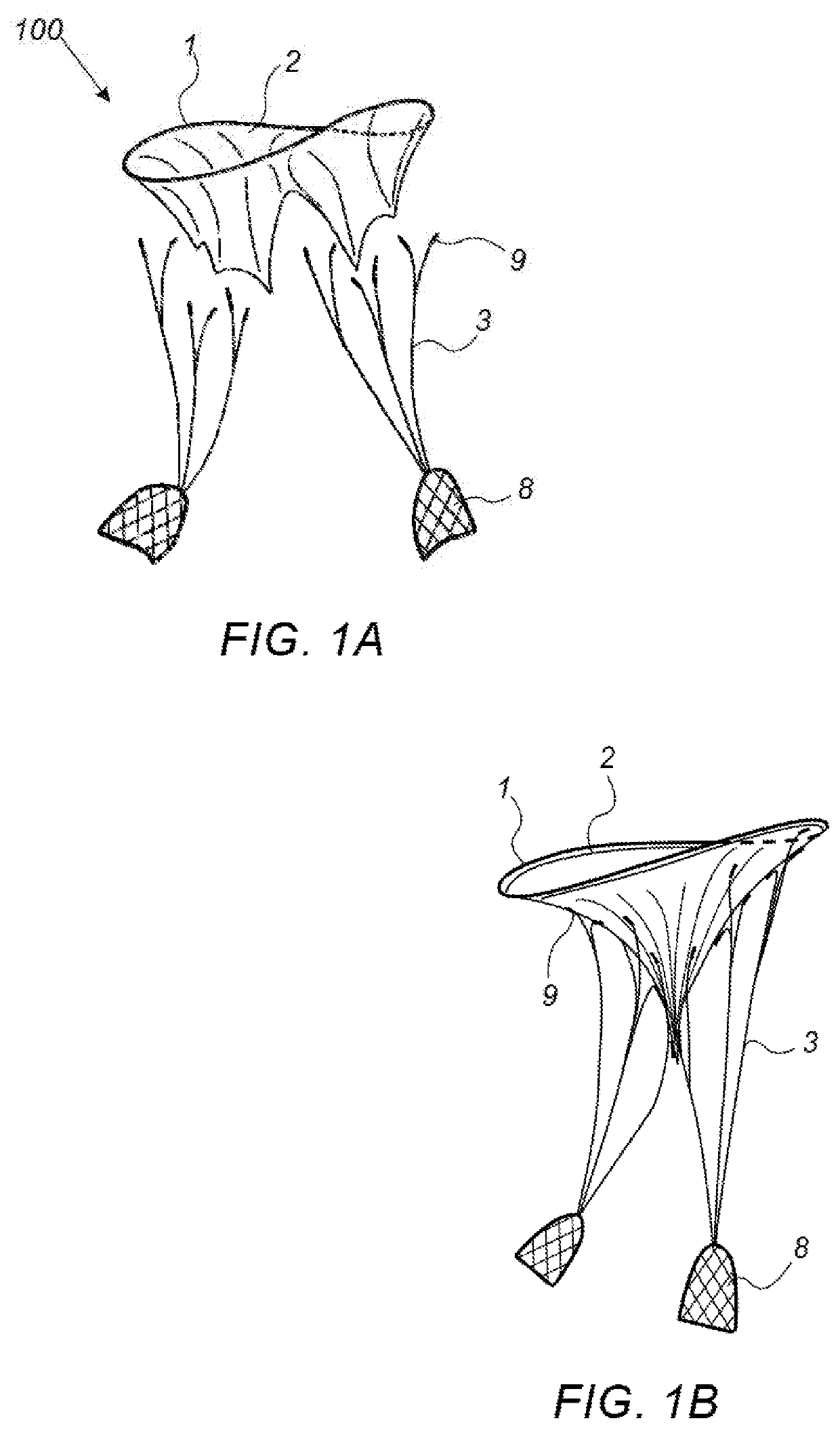 Naturally designed mitral prosthesis