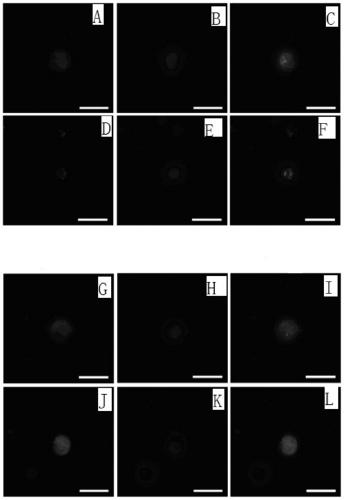 A three-dimensional induction method for in vitro differentiation of human spermatogonial stem cells into functional spermatids