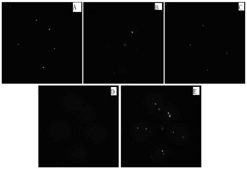 A three-dimensional induction method for in vitro differentiation of human spermatogonial stem cells into functional spermatids