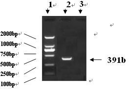 Nucleic-acid sequence-based amplification (NASBA) method for detecting swine influenza virus (SIV)