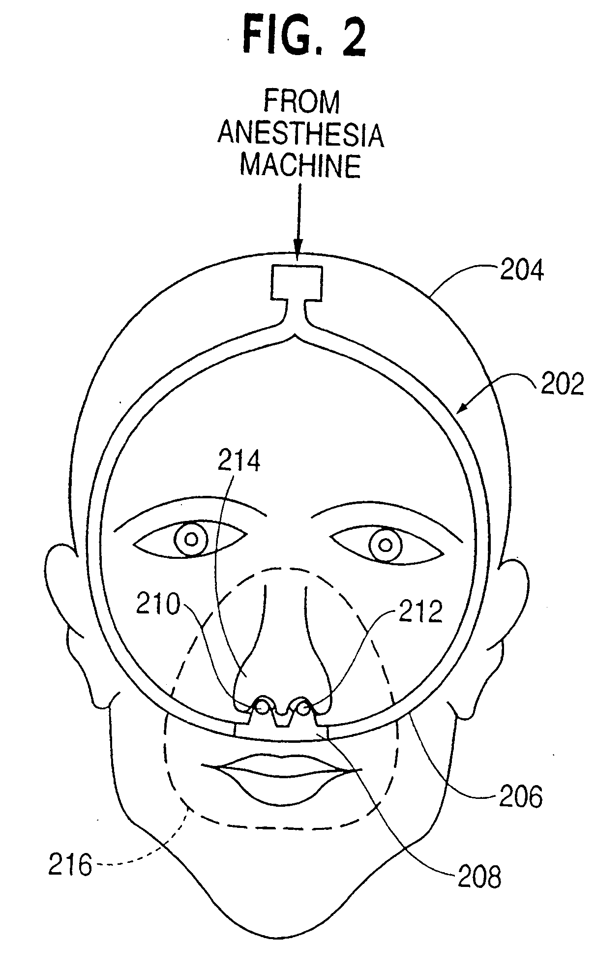 Nasal gas delivery system and method for use thereof
