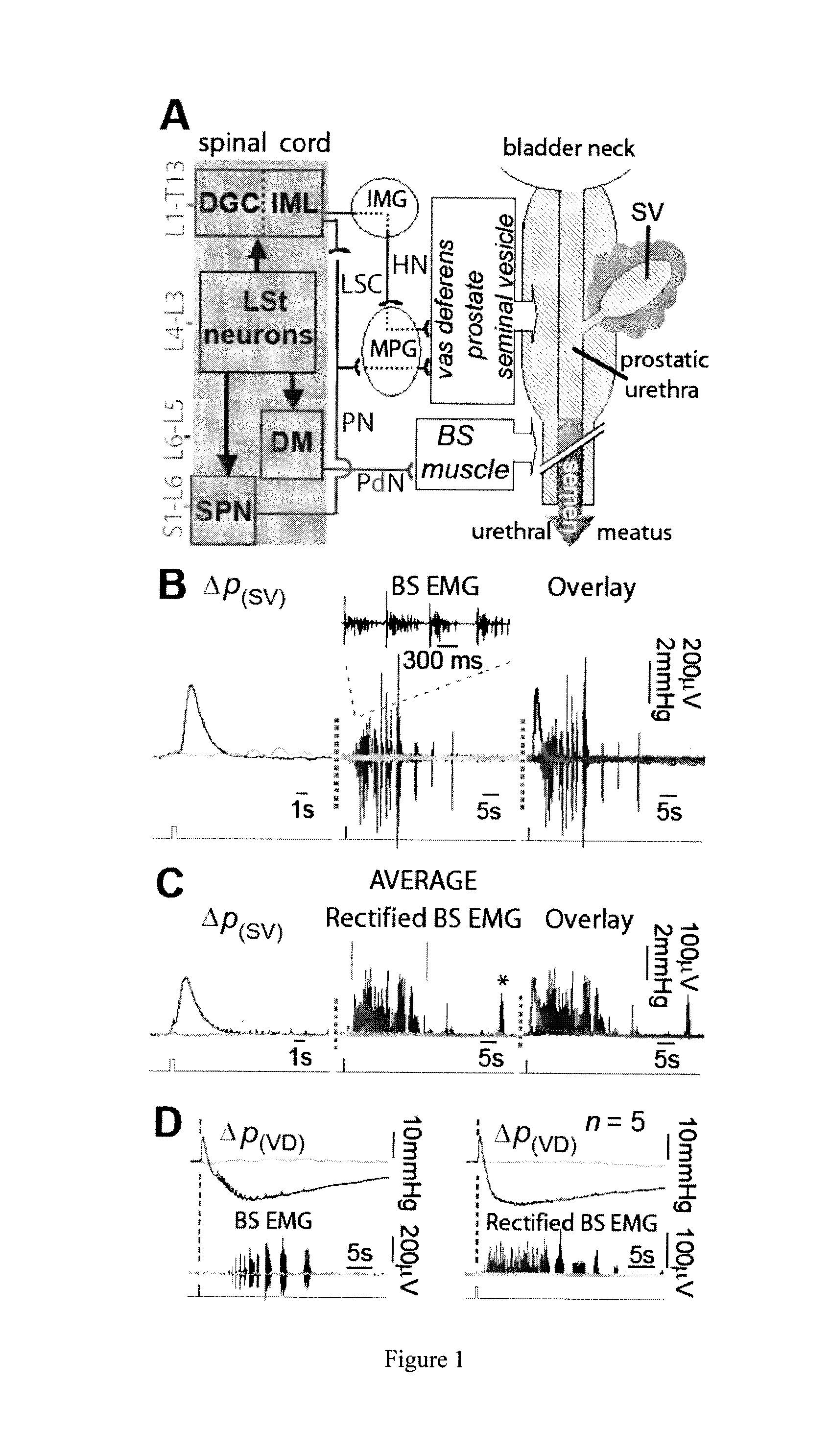 Method for Restoring an Ejaculatory Failure