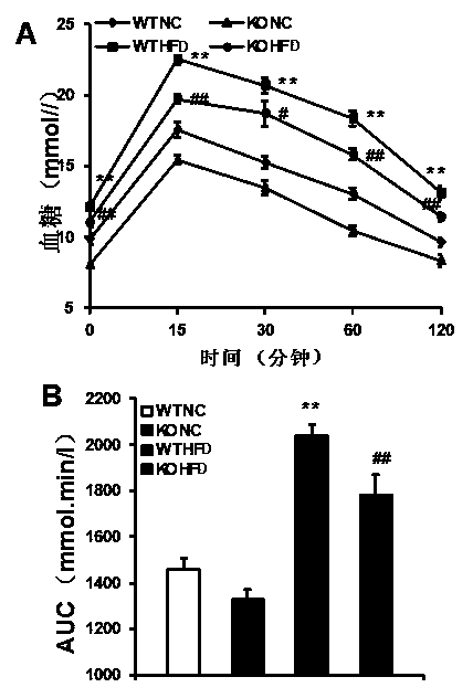 Functions and application of TNF (tumor necrosis factor) receptor associated factor 5 (TRAF5) in treatment of fatty liver and type 2 diabetes mellitus