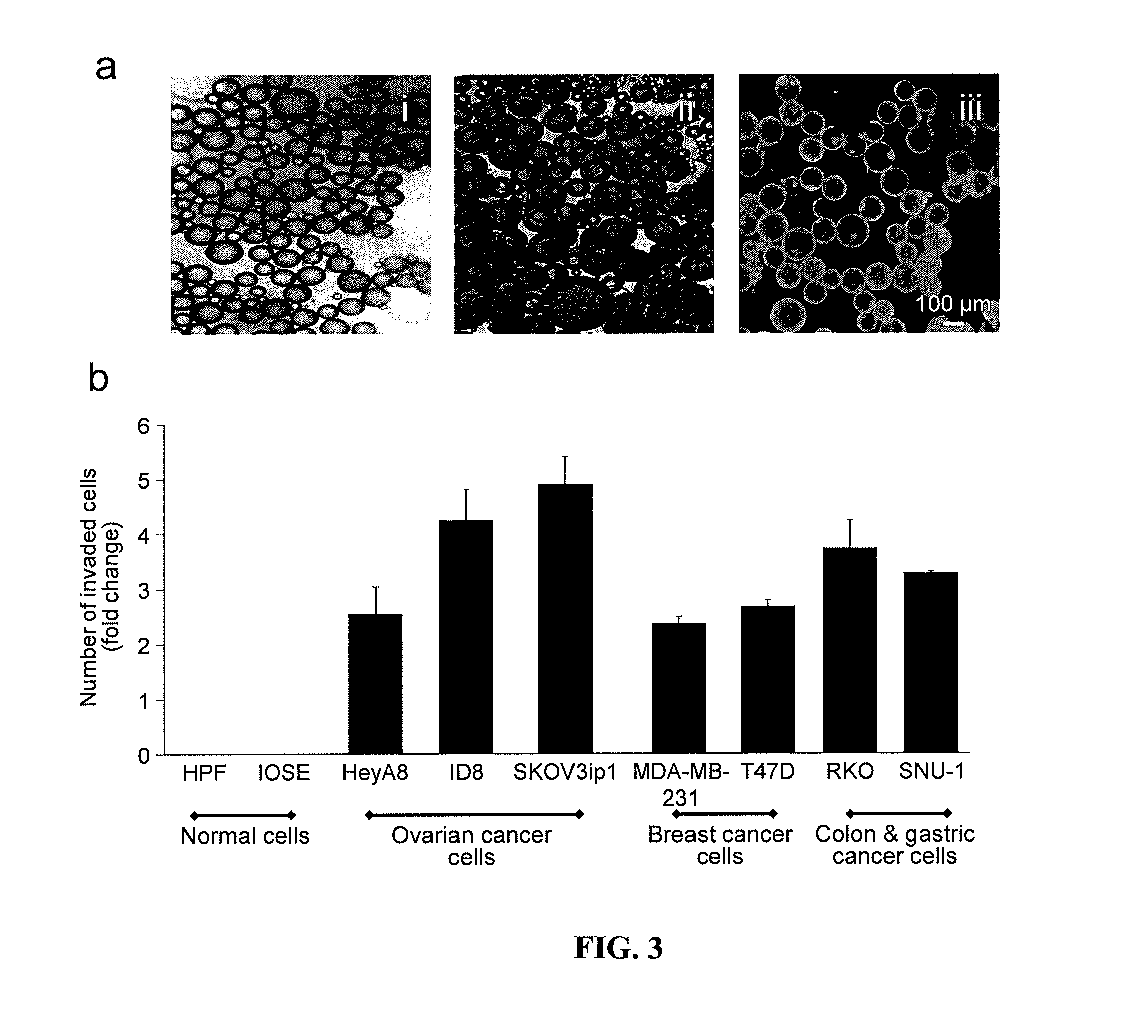 Compositions and methods for treating and/or preventing cancer by inhibiting fatty acid binding proteins