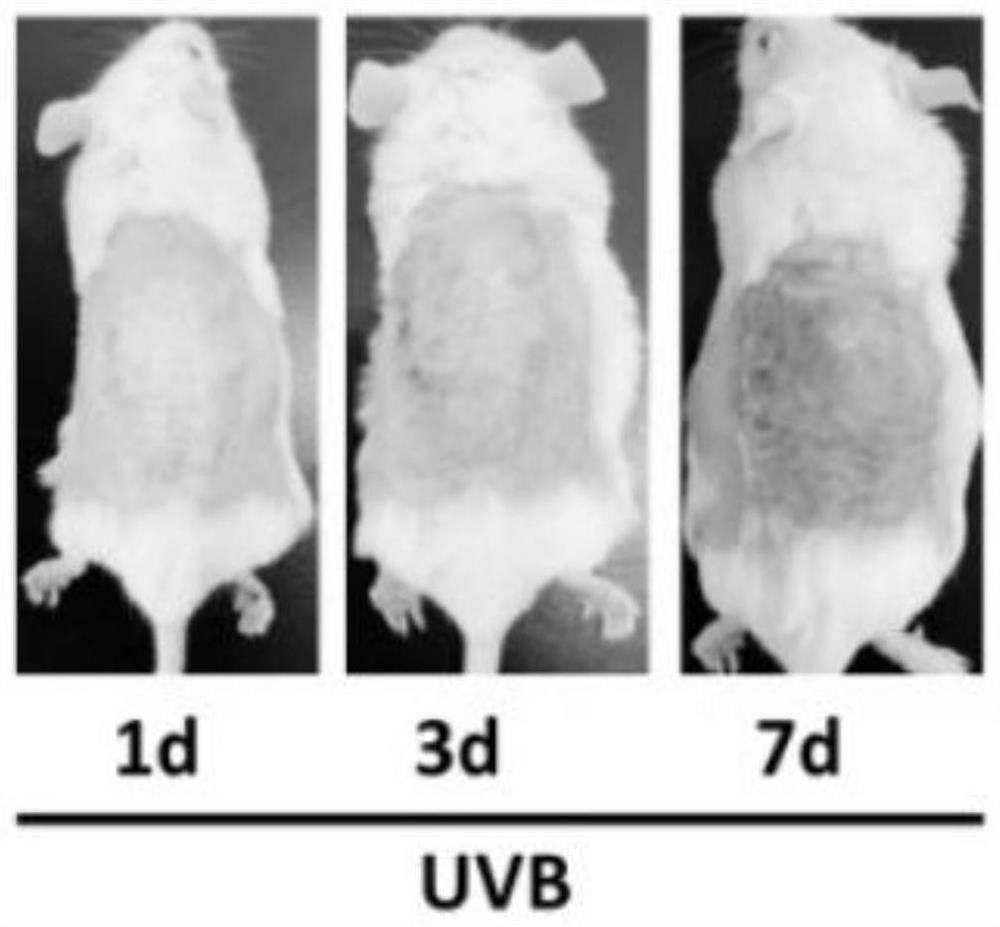 Application of fibroblast growth factor FGF21 to preparation of drug for treating skin ultraviolet injury