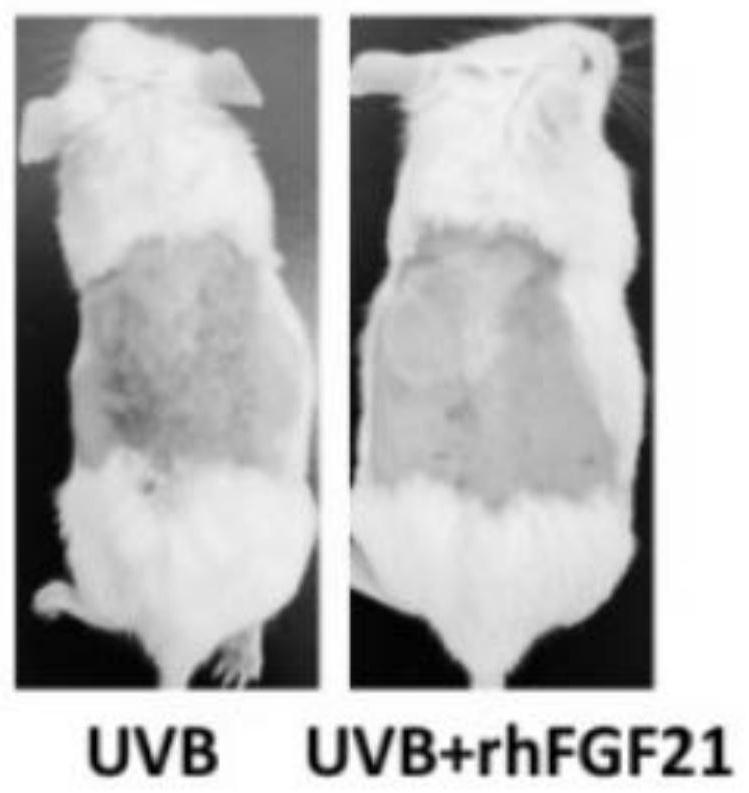 Application of fibroblast growth factor FGF21 to preparation of drug for treating skin ultraviolet injury