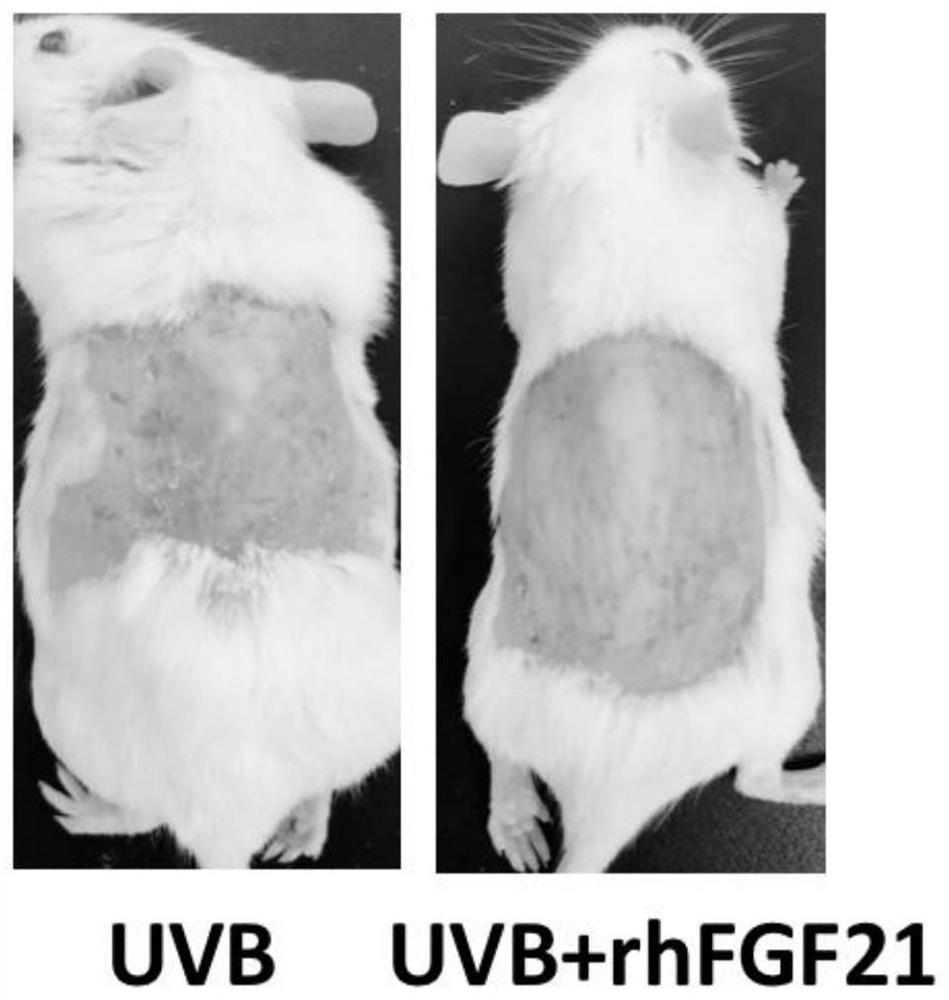 Application of fibroblast growth factor FGF21 to preparation of drug for treating skin ultraviolet injury