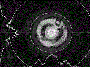 A device and method for realizing dynamic compensation of laser beam wavefront spherical aberration