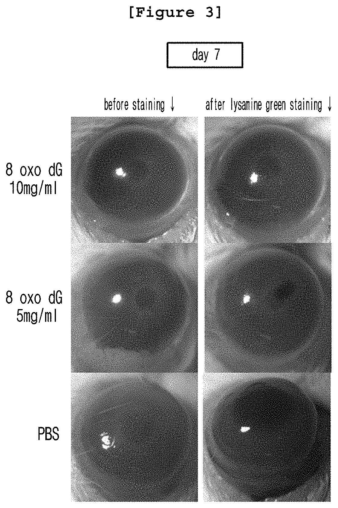 Pharmaceutical composition containing 8 OXO-deoxyguanosine or pharmaceutically acceptable salt thereof as active ingredient for treating corneal disease