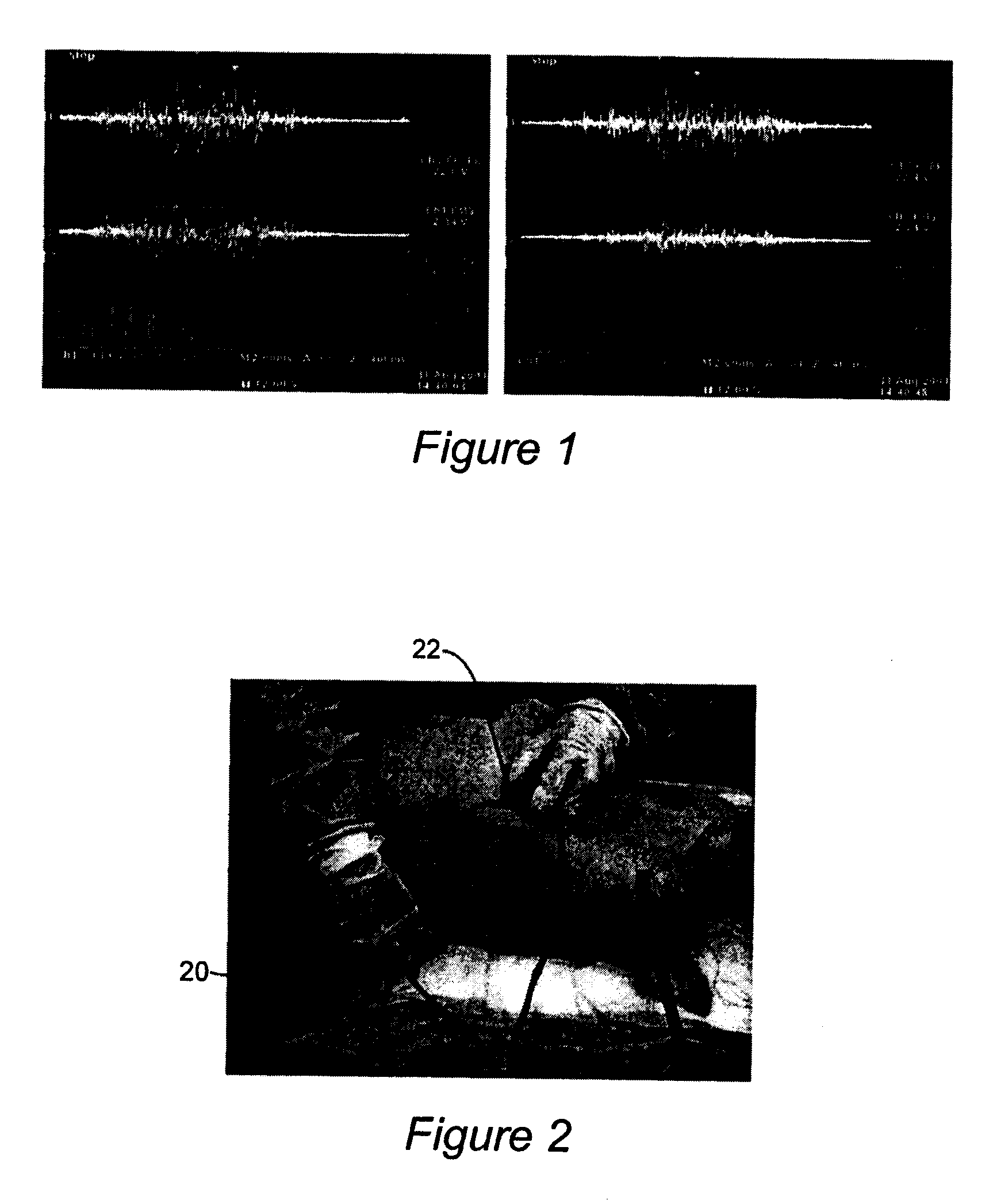 Portable Pulmonary Injury diagnostic Devices And Methods