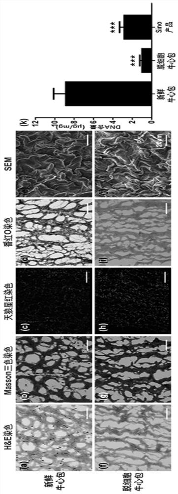 Natural polymer cross-linking agent and its application in the preparation of anti-calcification biological valve