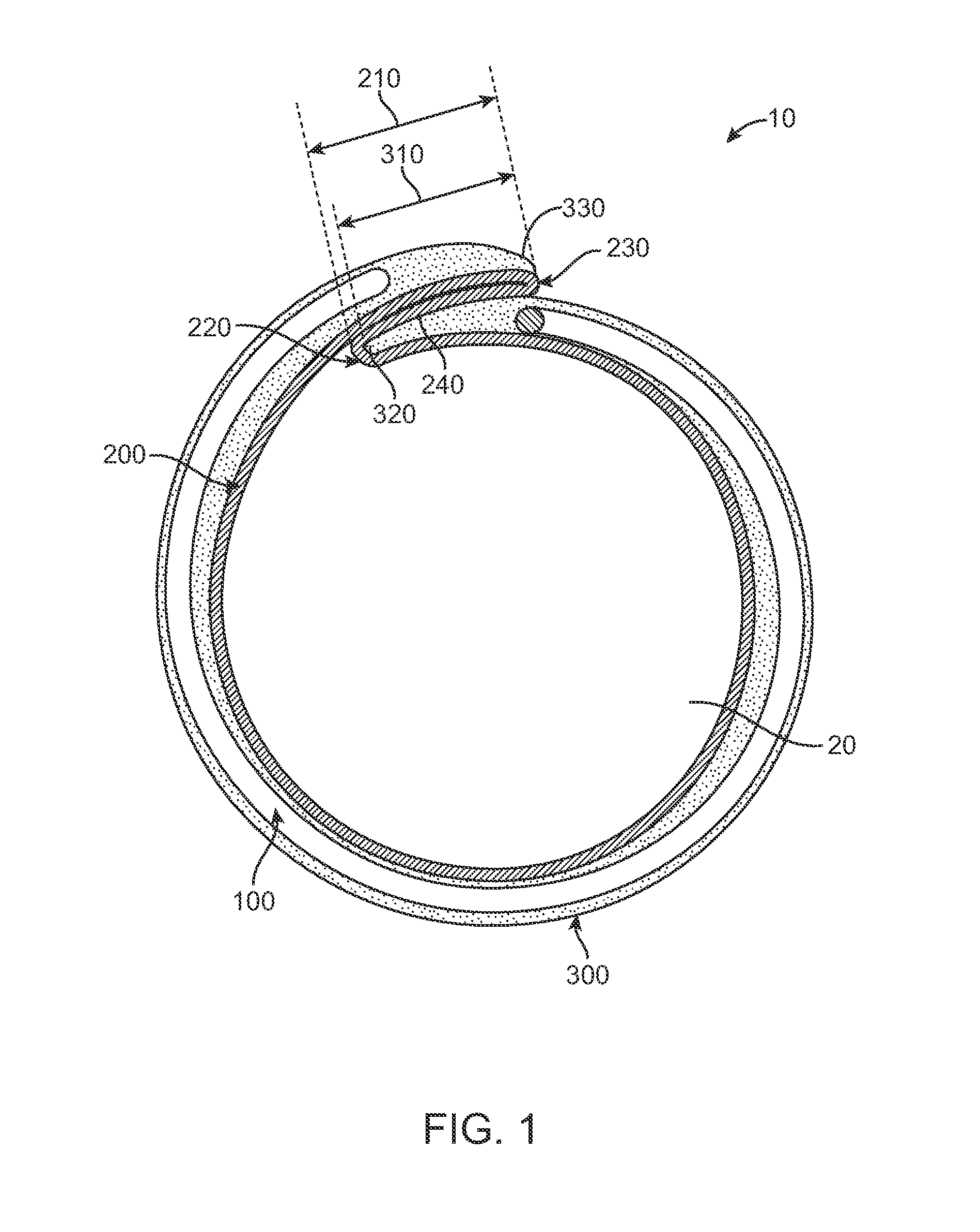 Elastic Introducer Sheath