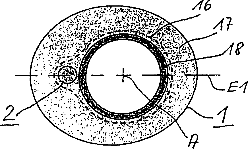 Module with surge arrester for a high-uoltage system