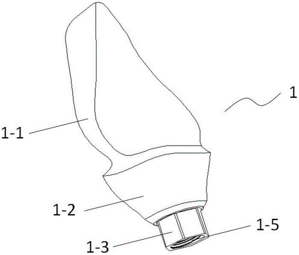 Customized abutment assembly and preparation method thereof