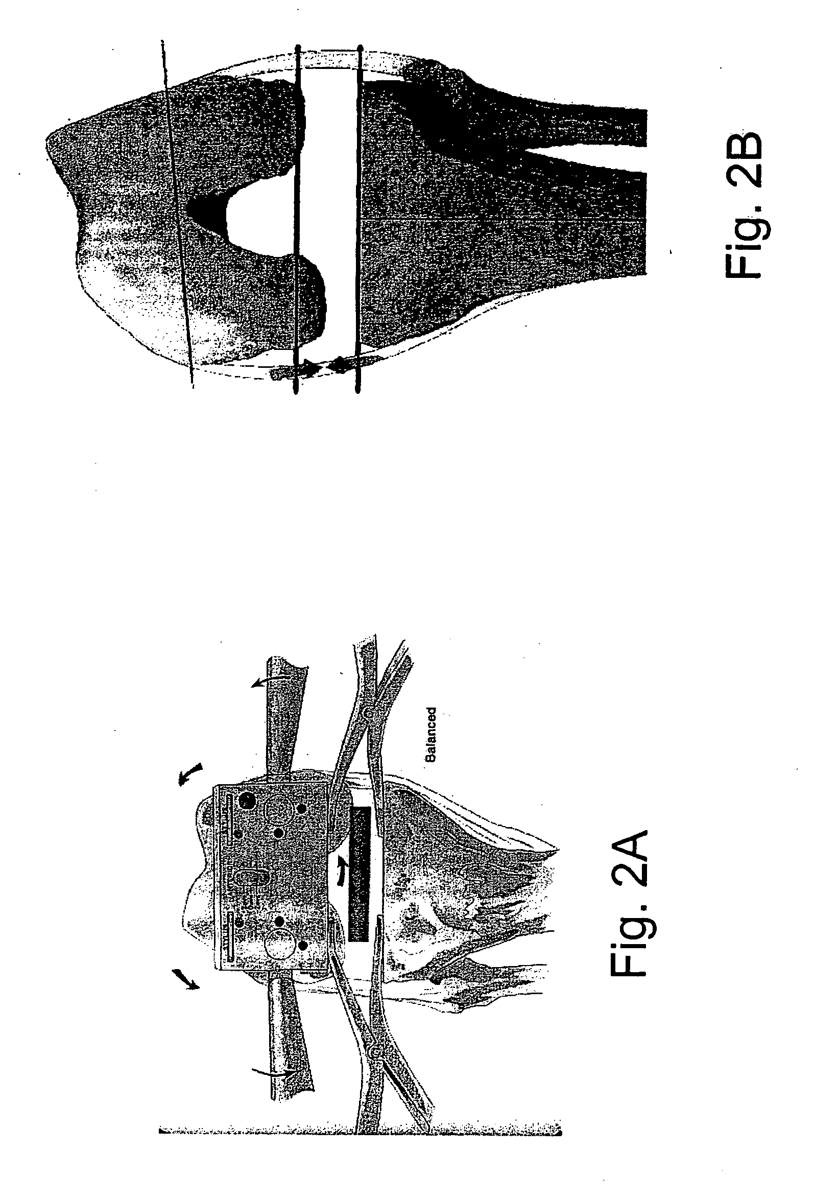 Methods and systems for intraoperative measurement of soft tissue constraints in computer aided total joint replacement surgery