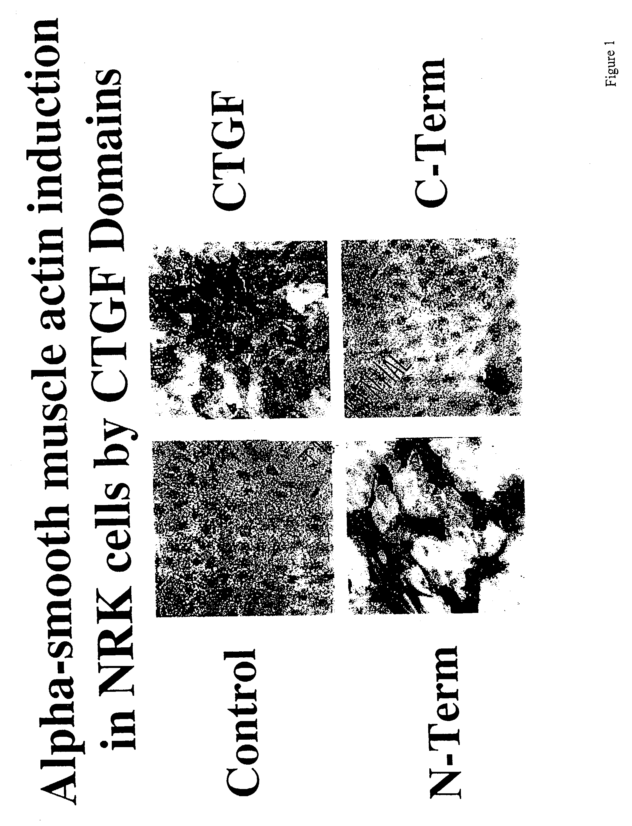 Antibodies directed to fragments of connective tissue growth factor (CTGF) polypeptide and methods and uses thereof