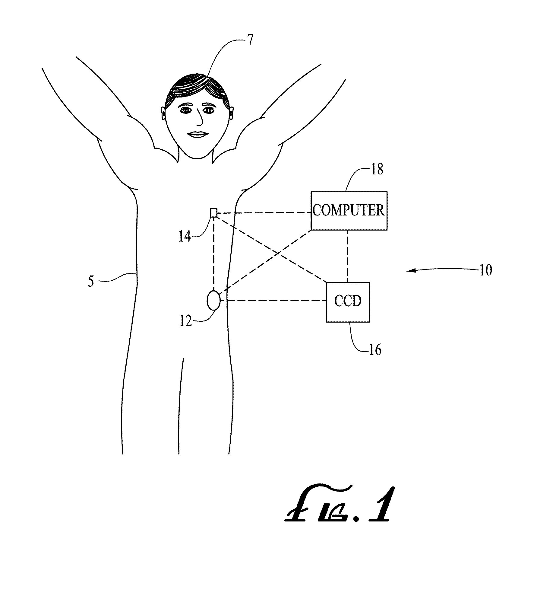 Connection and alignment systems and methods