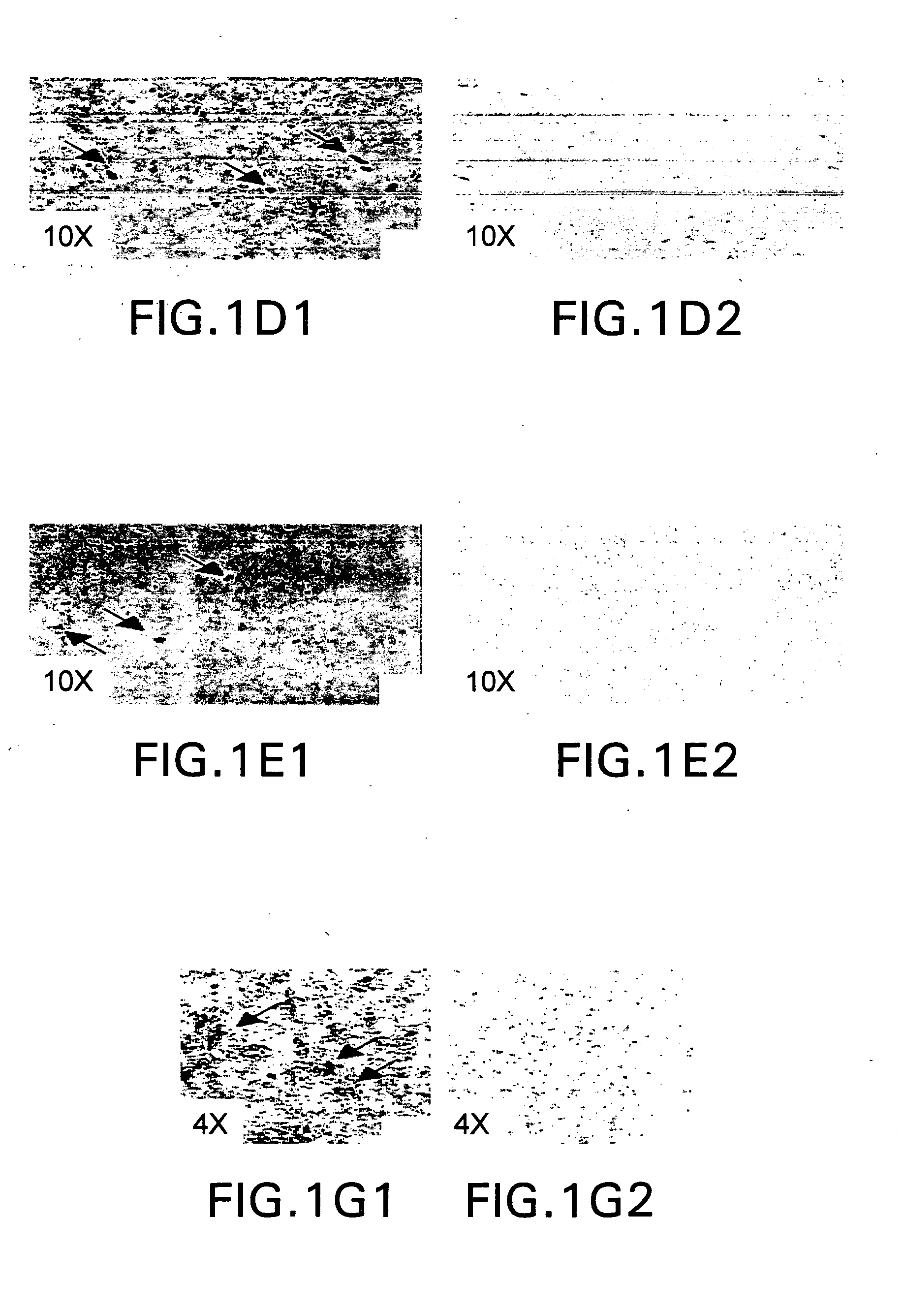 Vectors having both isoforms of beta-hexosaminidase and uses of the same