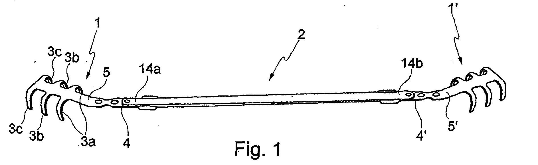 Implant, implant system, and use of an implant and implant system