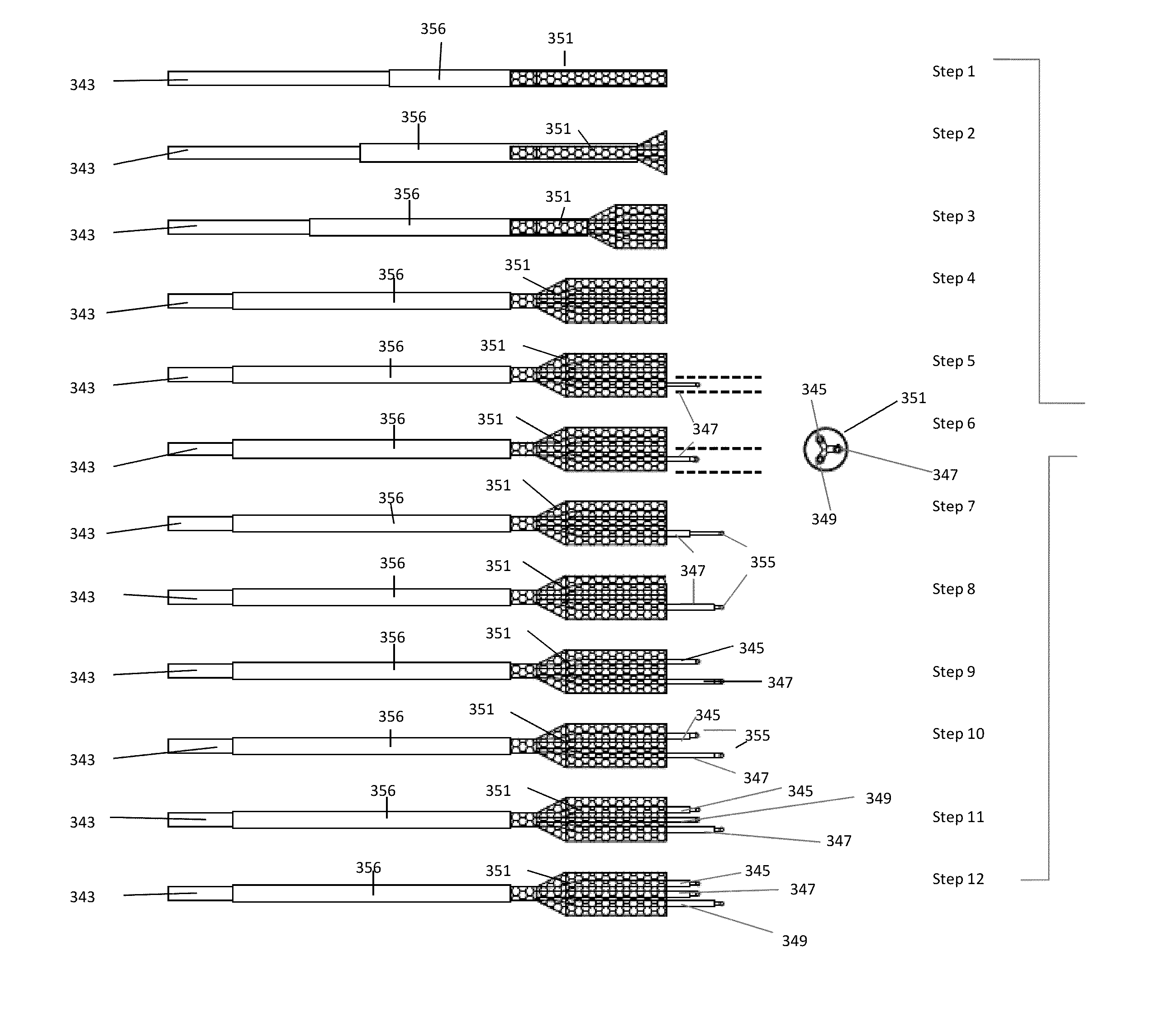 Catheter apparatus with telescoping lumen catheters and its use in methods for treating vasculatures